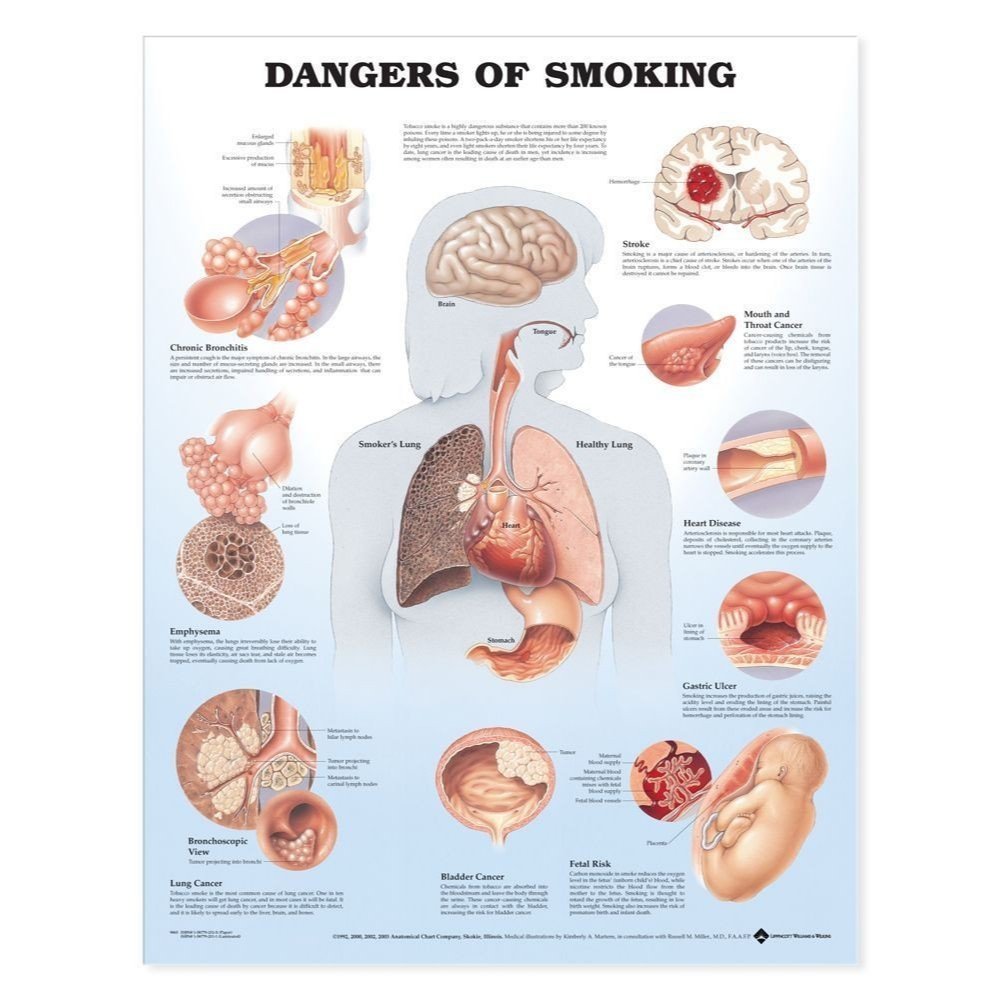 แผ่นโปสเตอร์ Dangers of Smoking Anatomical Chart (Paper) ed 1/2003