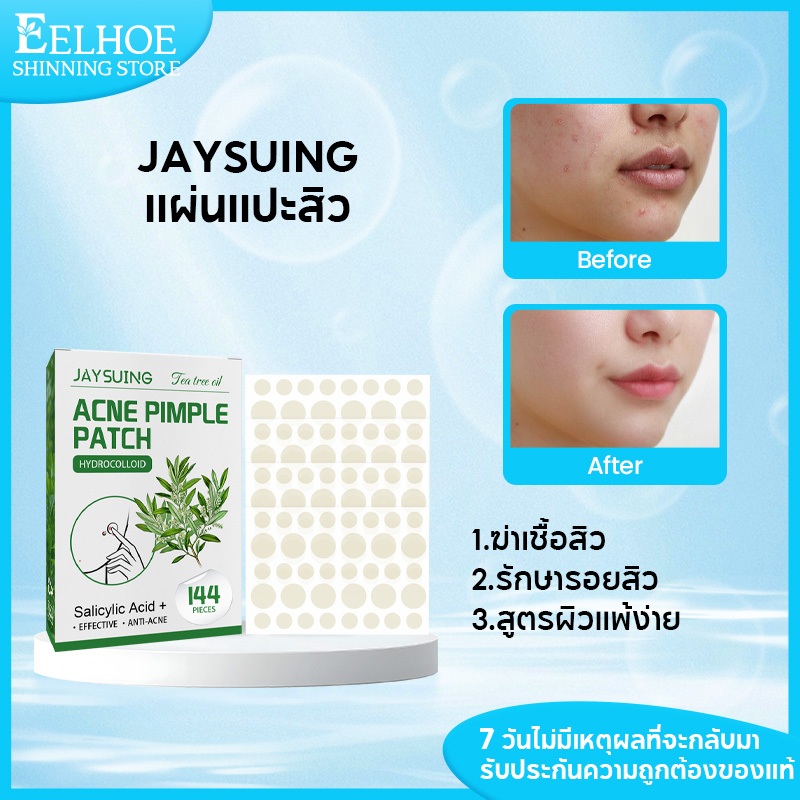 ​Jaysuing แผ่นแปะสิวไฮโดรคอลลอยด์ ชนิดมองไม่เห็น​ ดูดซับสิวเสี้ยน-สิวหนอง กันน้ำได้ ​144 ชิ้น