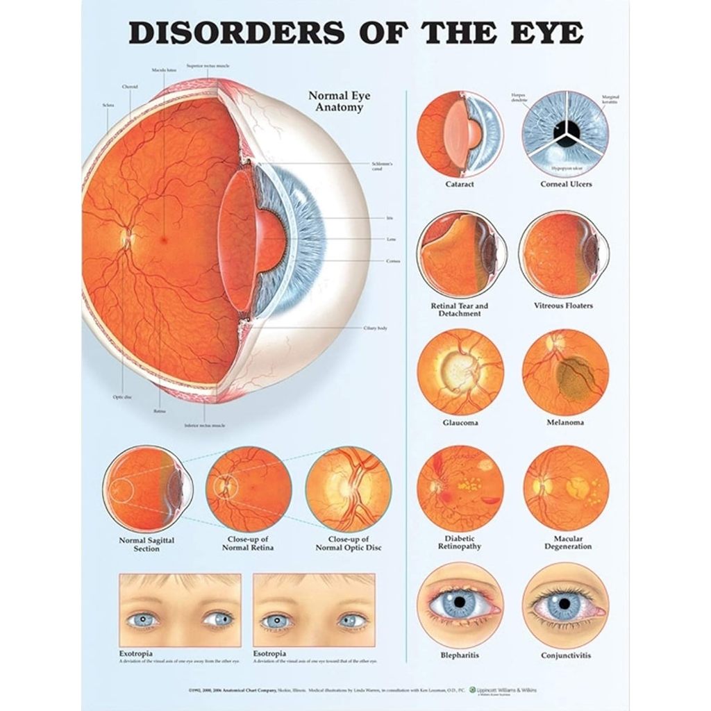 แผ่นโปสเตอร์ Disorders of the Eye Anatomical Chart (Paper) ed 2/2006