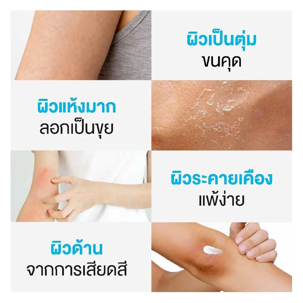 Dr.PONG U9.9 RENEWAL CREAM 50g  ครีมแก้ผิวแห้งลอก ขนคุด ศอกด้าน เข่าด้าน ผิวนุ่มชุ่มชื้น thumbnail 9