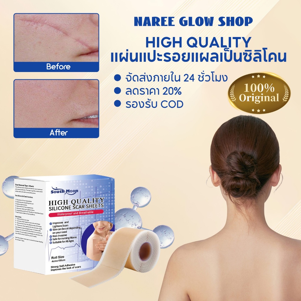 South Moon รักษารอยแผลเป็น แผ่นแปะแผลเป็น กําจัดรอยแผลเป็นจากแผลเป็น เทปเจลแผลเป็นไหม้ แผ่นปิดแผล ลดรอยแผลเป็นนูนแดง