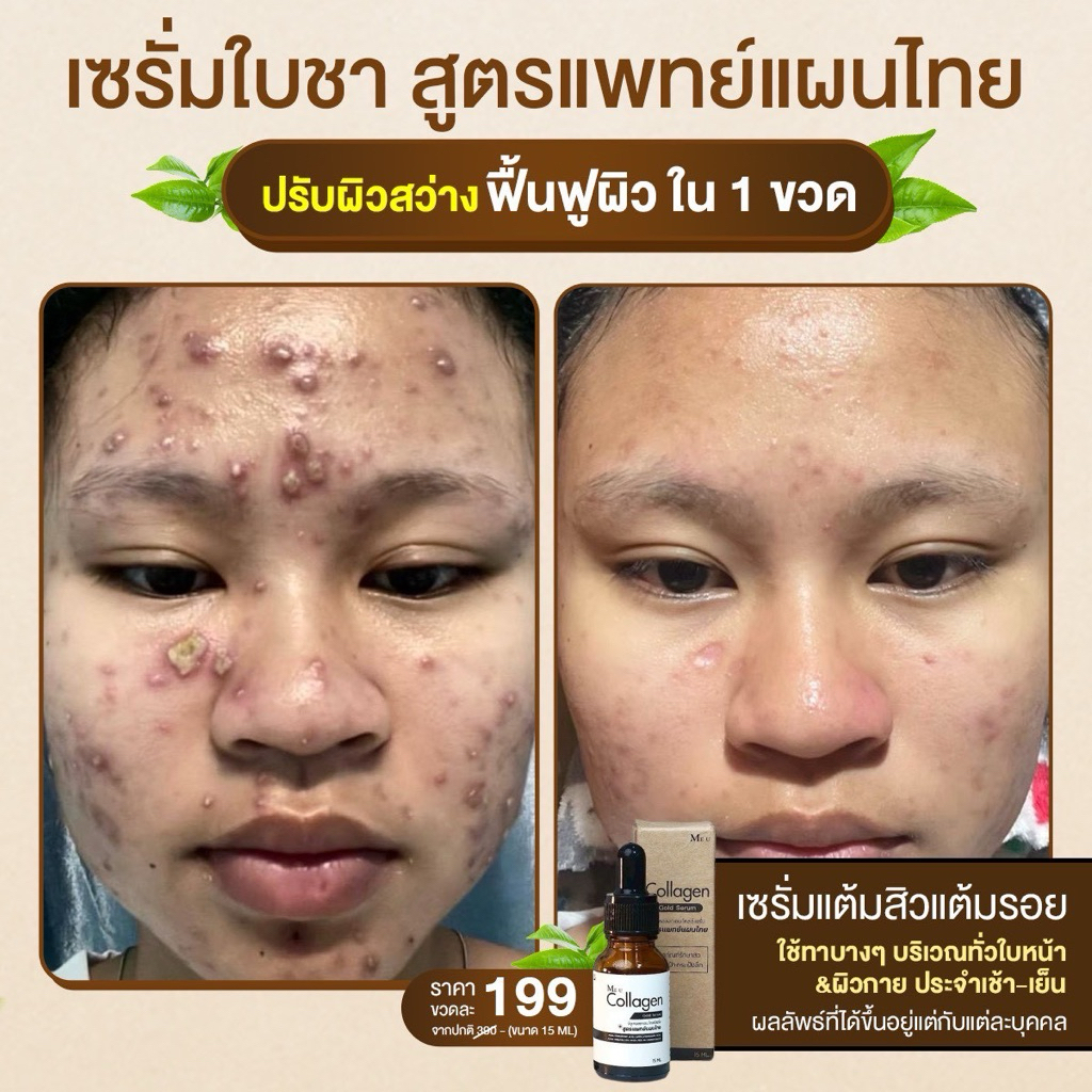 เซรั่มใบชา สูตรแพทย์แผนไทย Collagen Gold Serum