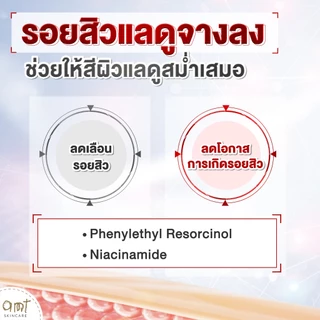 AMT Liposome Acne Spot Serum 7 mL - เจลแต้มสิว 2 in 1" จบปัญหาสิว ไม่ทิ้งรอย ในหลอดเดียว