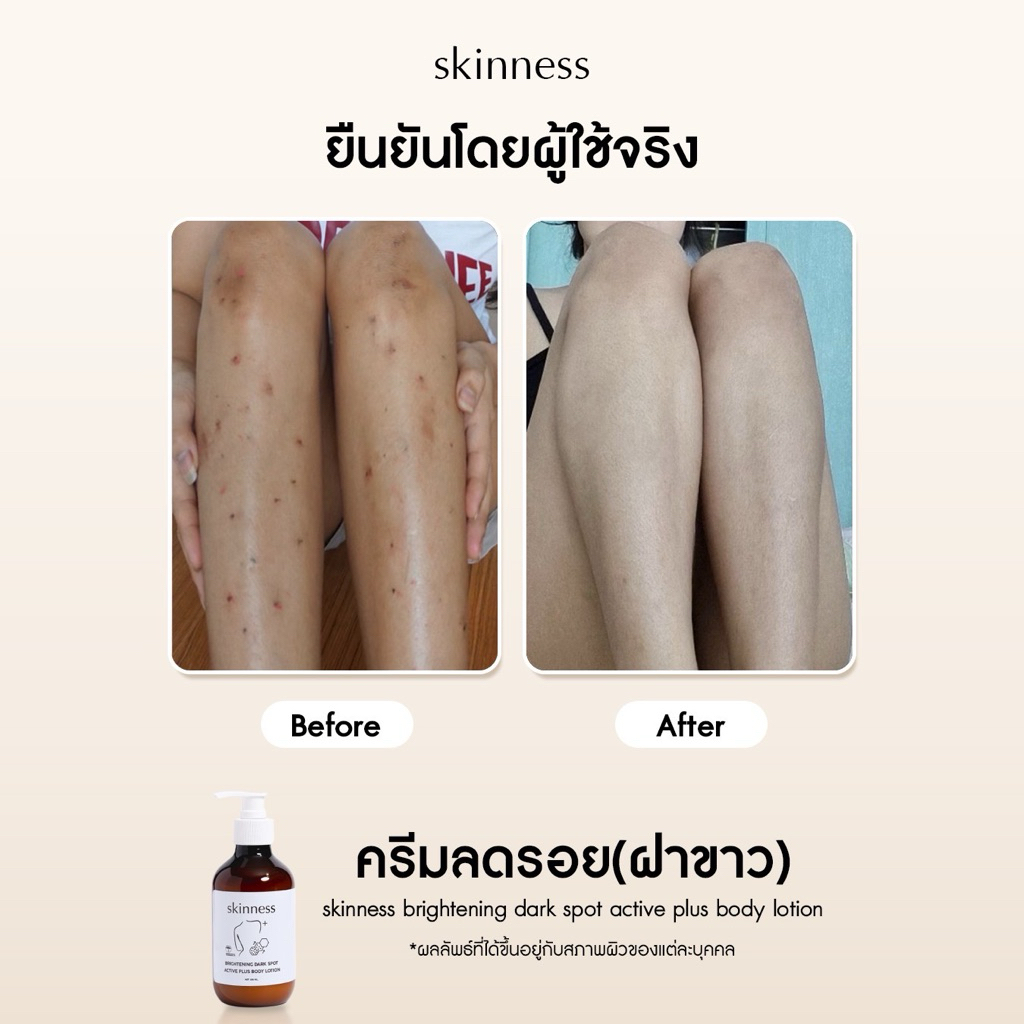 สูตรใหม่! [พร้อมส่งทุกวัน] skinness brightening dark spot active plus body lotion | ครีมลดรอยดำสูตรฝาขาว รูปที่ 4