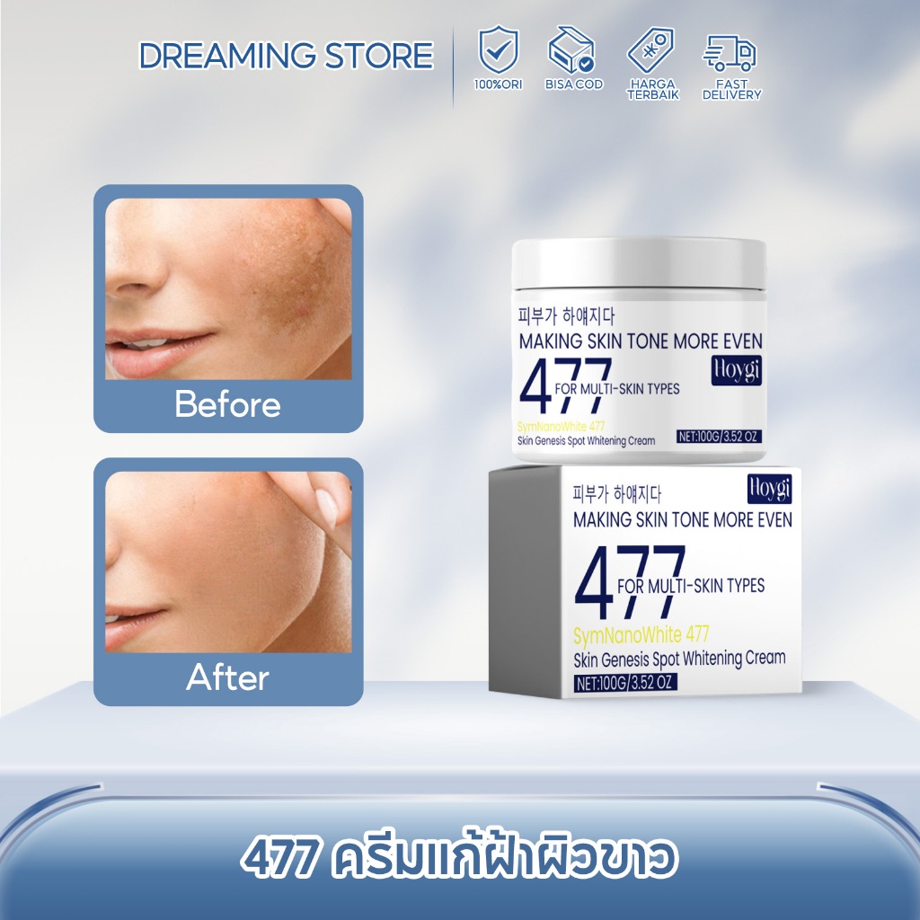 Hoygi ครีม 477 ครีมแก้ฝ้าผิวขาว ผิวขาว ลดข้อบกพร่อง บำรุงผิวโกลว์ ครีมทาหน้า ชุ่มชื้น ลดริ้วรอย ครีม