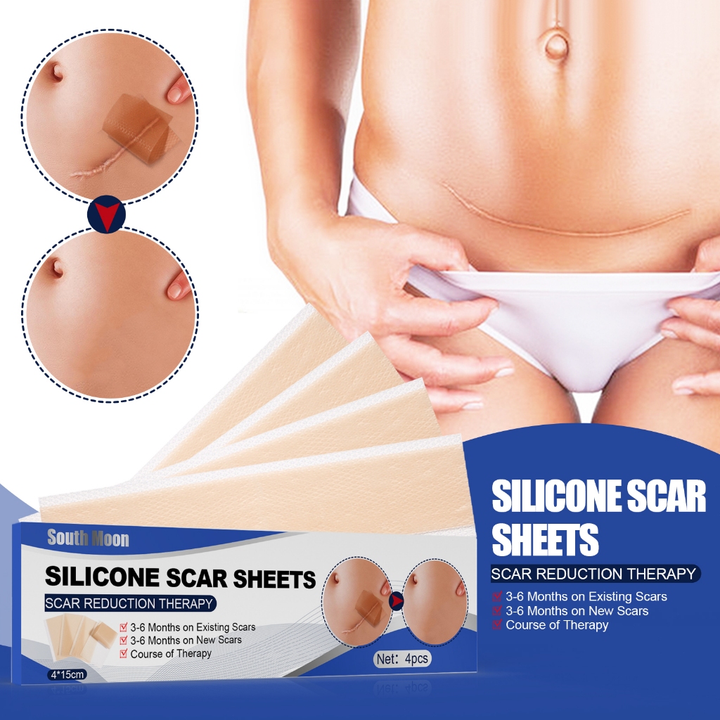 South Moon แผ่นแปะแผลเป็น 4แผ่น/กล่อง แผ่นเจลซิลิโคน สําหรับซ่อมแซมรอยแผลเป็น แผ่นแปะแผลเป็น