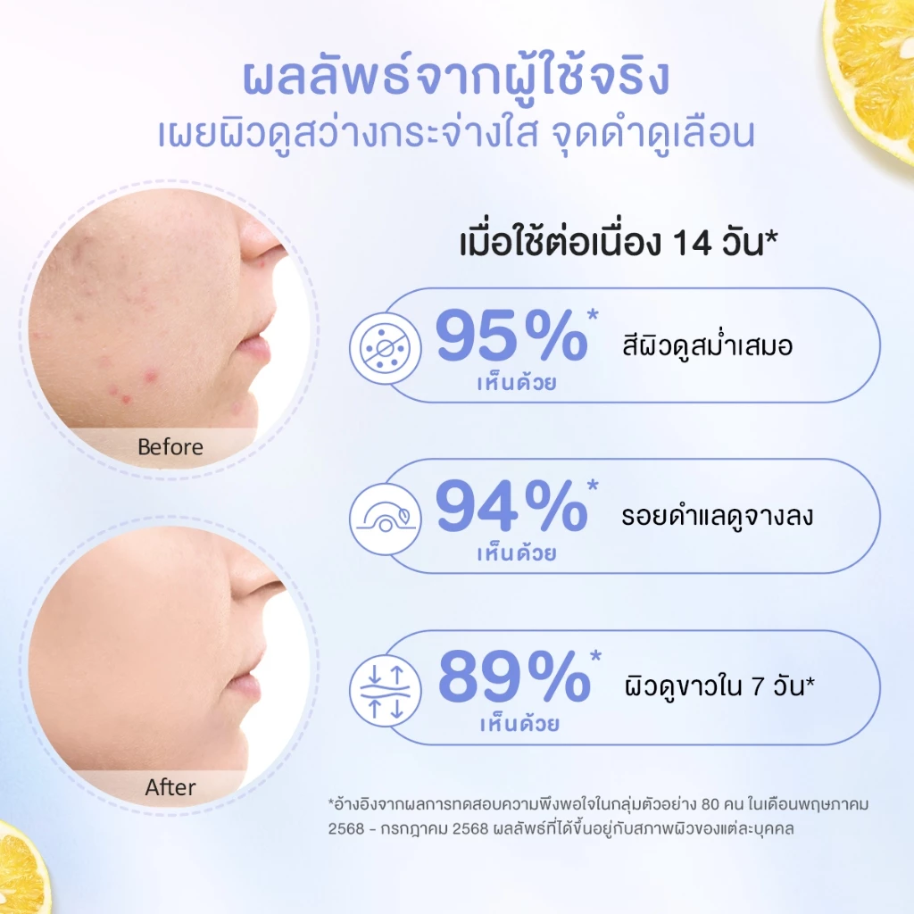 【Proxie's Pick】Glad2Glow Yuja Symwhite 377 Dark Spot Moisturizer มอยเจอร์ไรเซอร์ ครีม ครีมทาหน้า สกินแคร์ thumbnail 3