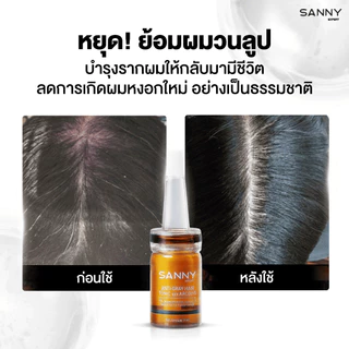 [สินค้าขายดี] SANNY เซรั่มโทนิคลดผมหงอก ปิดผมขาว กระตุ้นเม็ดสีผมเข้มขึ้น 7ml.