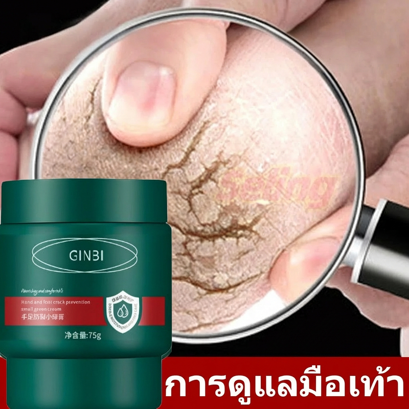 ครีมทาส้นทาแตก ครีมทาเท้าแตก ที่ขัดเท้าแตก ครีมบำรุงเท้า เท้าแตก ดูแลมือ ขัดผิวหนัง แห้ง หยาบ หนังแ
