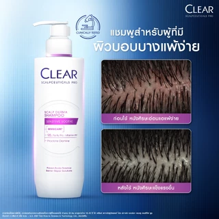 [เคลียร์พรีเมี่ยม][แพ็คคู่] เคลียร์ สกาล์ปซูติคอลส์ โปรแชมพู 300มล.x2 สูตรลดผมขาดหลุดร่วงและสูตรอ่อนโยน (เลือกสูตรด้านใน