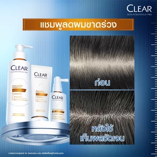 [เคลียร์พรีเมี่ยม][แพ็คคู่] เคลียร์ สกาล์ปซูติคอลส์ โปรแชมพู 300มล.x2 สูตรลดผมขาดหลุดร่วงและสูตรอ่อนโยน (เลือกสูตรด้านใน