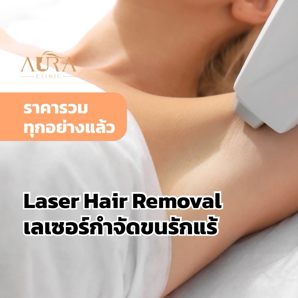 เลเซอร์กำจัดขนรักแร้ 1 ครั้ง Aura Clinic (เข้ารับบริการที่คลินิก)