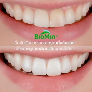 [1ฟรี3] Dentiste' Repaire เซรั่มฟัน 2in1 70g เพิ่มเนื้อผิวฟัน ป้องกันฟันผุ เสริมเคลือบฟัน ฟรี Brush x2 Advanced Care x1