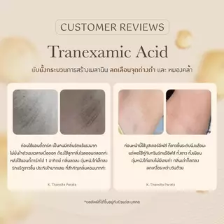 [ส่งด่วน] EVES อีฟส์ บำรุงผิวกาย บูสเตอร์ส้ม ครีมทารักแร้ แอนตี้ดาร์ก โลชั่นกันแดด ผิวกายกระจ่าง วงแขนเรียบเนียน กันแดด