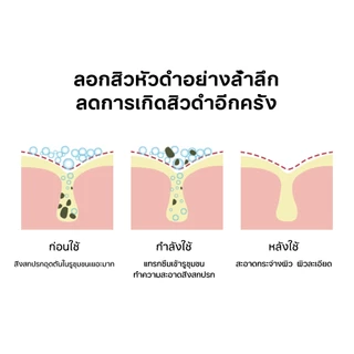 มาส์กกำจัดสิวหัวดำ มาส์กจมูกสิวหัวดำ มาร์คโคลน 60g ลอกสิวหัวดำ ลอกสิวเสี้ยน รูขุมขนสะอาด กระชับรูขุมขน ผิวแพ้ง่ายใช้ได้