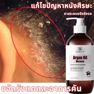[ขายดี] แชมพูรังแค แชมพูคัน แชมพู & ครีมนวด 500ml แชมพูแก้คั…