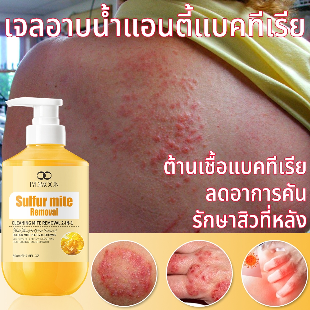 เจลอาบน้ำกำมะถัน 500ml สบู่อาบน้ำลดสิว ต่อต้านเชื้อรา กำจัดไร แก้ผื่นคัน ลดสิวกาย สูตรอ่อนโยน ดูแลผิวตัว Acne Body Wash