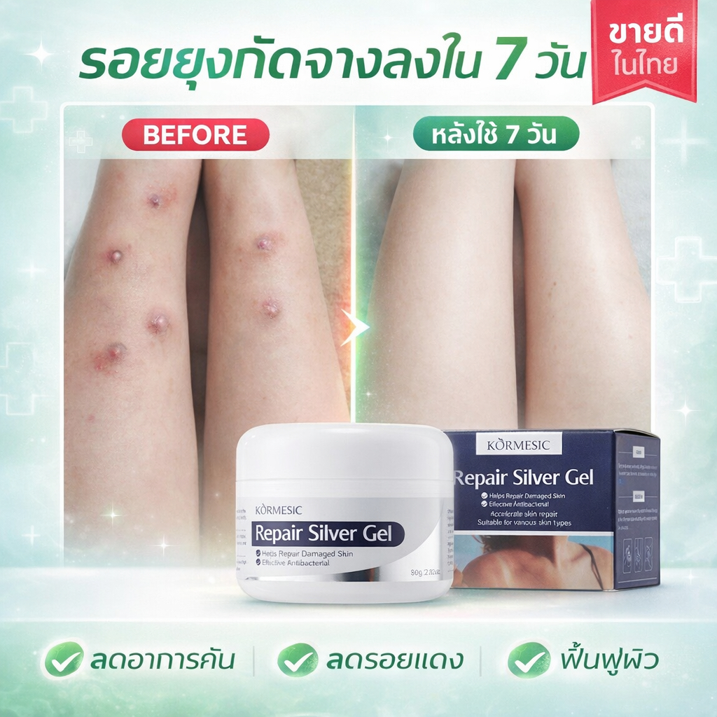 【1 ครั้งเห็นผล】ลบรอยแผลเป็นสีดำ ครีมทาแผลเป็น ครีมลบรอยแผลเป็น ลบรอยแผลเป็นเก่าที่ขา ขวด ครีมลบรอยแผลเป็น 80ก