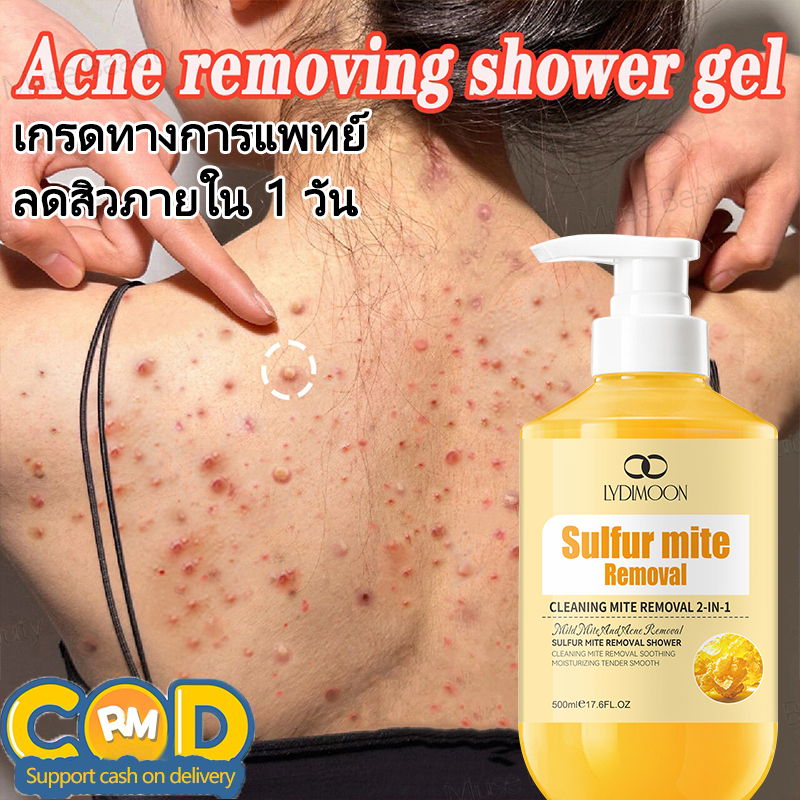 ครีมอาบน้ําลดสิว Antibacterial Shower Cream ครีมอาบน้ำ กำจัดไรลดสิว หน้าอก ลดสิวที่หลัง ลดการสะสมของแบคทีเรีย 99.8%