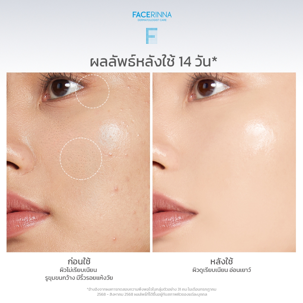 Facerinna كريم ريتينول مضاد للتجاعيد — صورة 8