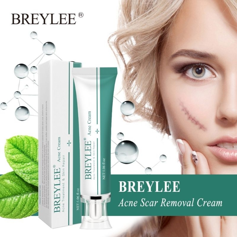 ✨ BREYLEE ครีมทาแผลเป็น ของแท้ พร้อมส่ง ลดรอยสิว รอยดำ รอยแดง รอยแตกลาย 30g