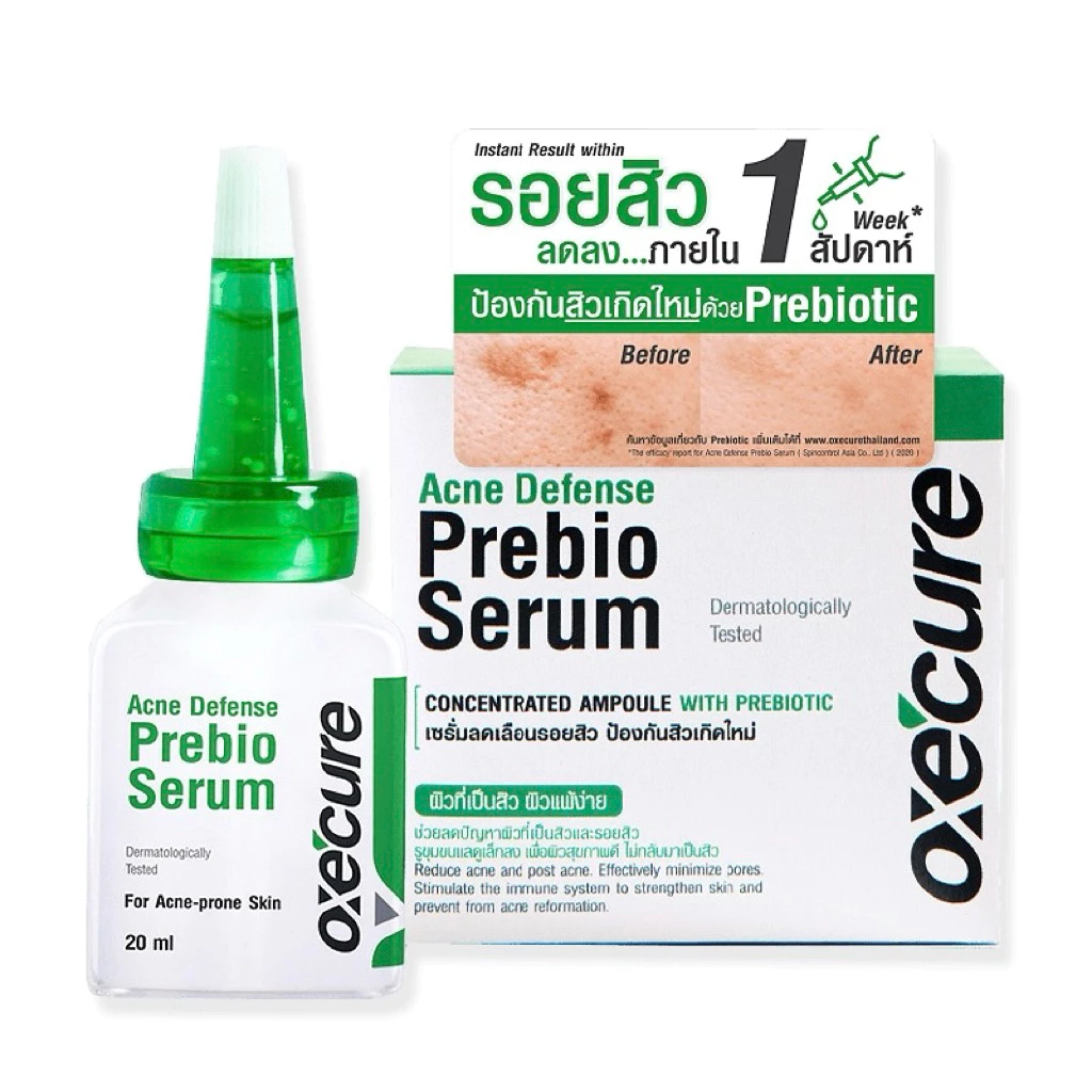พร้อมส่ง💓| OxeCure Acne Defense Prebio Serum 20 ml. อ๊อกซีเคียว เซรั่มเข้มข้นลดรอยสิว ❎EXP.07/27