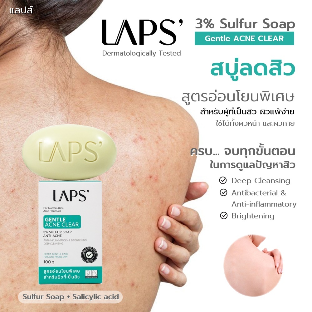 LAPS' Gentle ACNE CLEAR สบู่ซัลเฟอร์ 3% + BHA + Zinc PCA  เวชสำอางลดสิว สูตรอ่อนโยน สำหรับผิวแพ้ง่าย