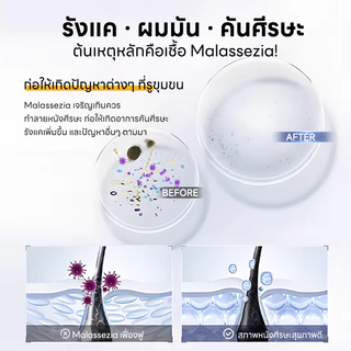 Dr.eyemo แชมพูขจัดรังแค Shampoo 500Ml ป้องกันการกลับมาเป็นซ้ำ 3in1 ทำความสะอาด ชุ่มชื้น กำจัดรังแค