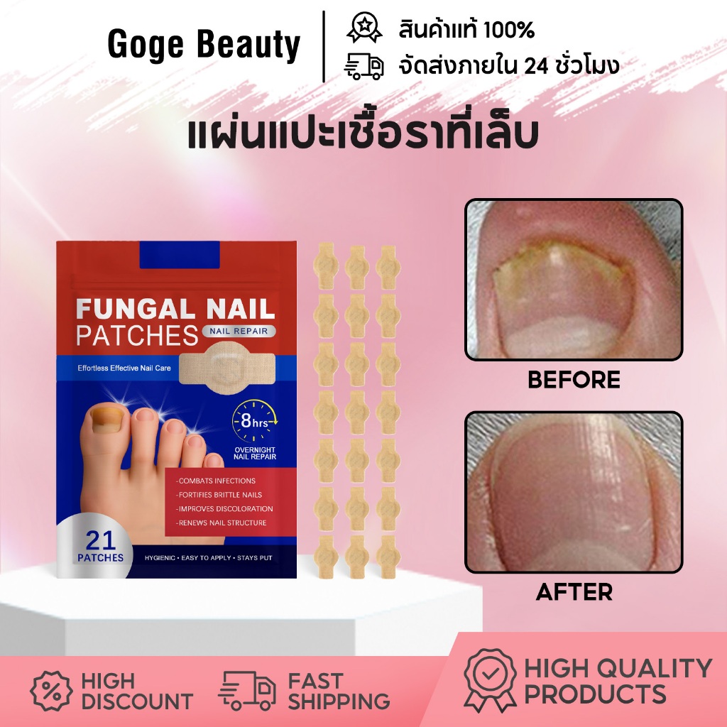Ximonth แผ่นแปะเชื้อราที่เล็บ แผ่นแปะเล็บ 21pcs ซ่อมแซมเล็บ รักษาเชื้อราเล็บเท้า รักษาเล็บให้แข็งแรง