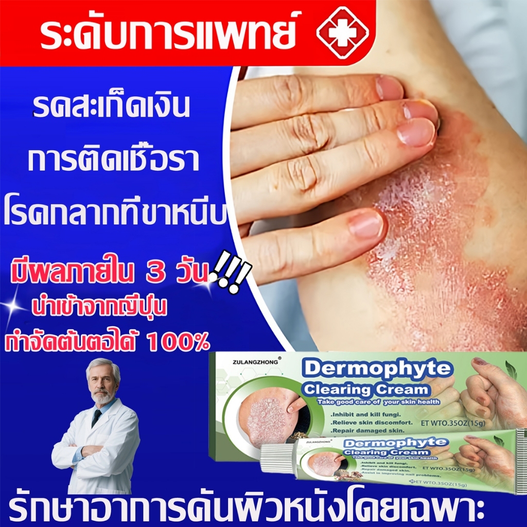 🔥ครีมทาสังคัง สะเก็ดเงินครีม 20g รอยแดง โรคผิวหนัง เกลื้อน กลาก คัน สมุนไพร แก้คันเรื้อรัง คันในร่มผ้า ครีมลดอาการคัน