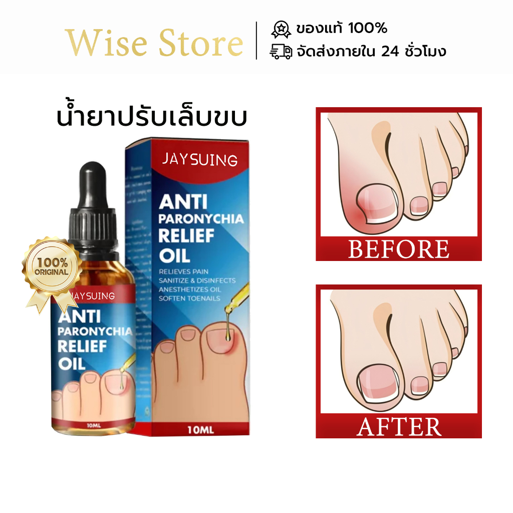 Jaysuing รักษา เล็บขบ ปรับเล็บขบ โรคติดเชื้อที่ขอบเล็บ เล็บแตก ซ่อมแซมเล็บ รักษาเชื้อราที่เล็บ