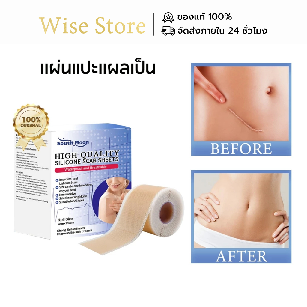 【🚚พร้อมส่ง】South Moon silicone scar sheet รักษารอยแผลเป็น แผ่นแปะแผลเป็น คีลอยด์ แผลนูน กําจัดรอยแผล