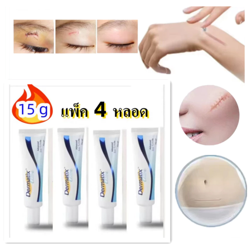เจลทาผิวใส ขนาด15 กรัม ราคาส่ง แพ็ค4หลอด