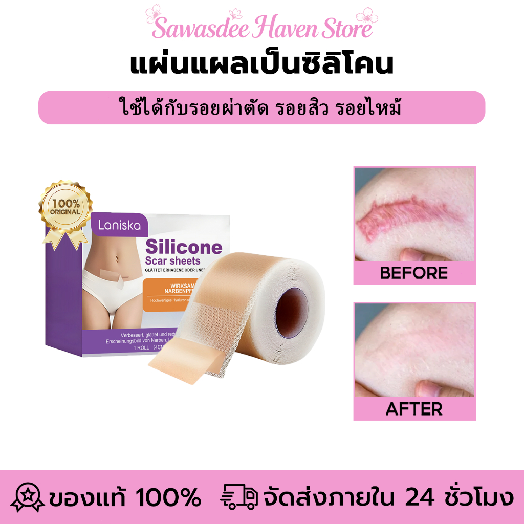 Laniska แผ่นแผลเป็นซิลิโคน ใช้ได้กับรอยผ่าตัด รอยไหม้ รอยสิว ใช้ซ้ำได้  4cm*150cm