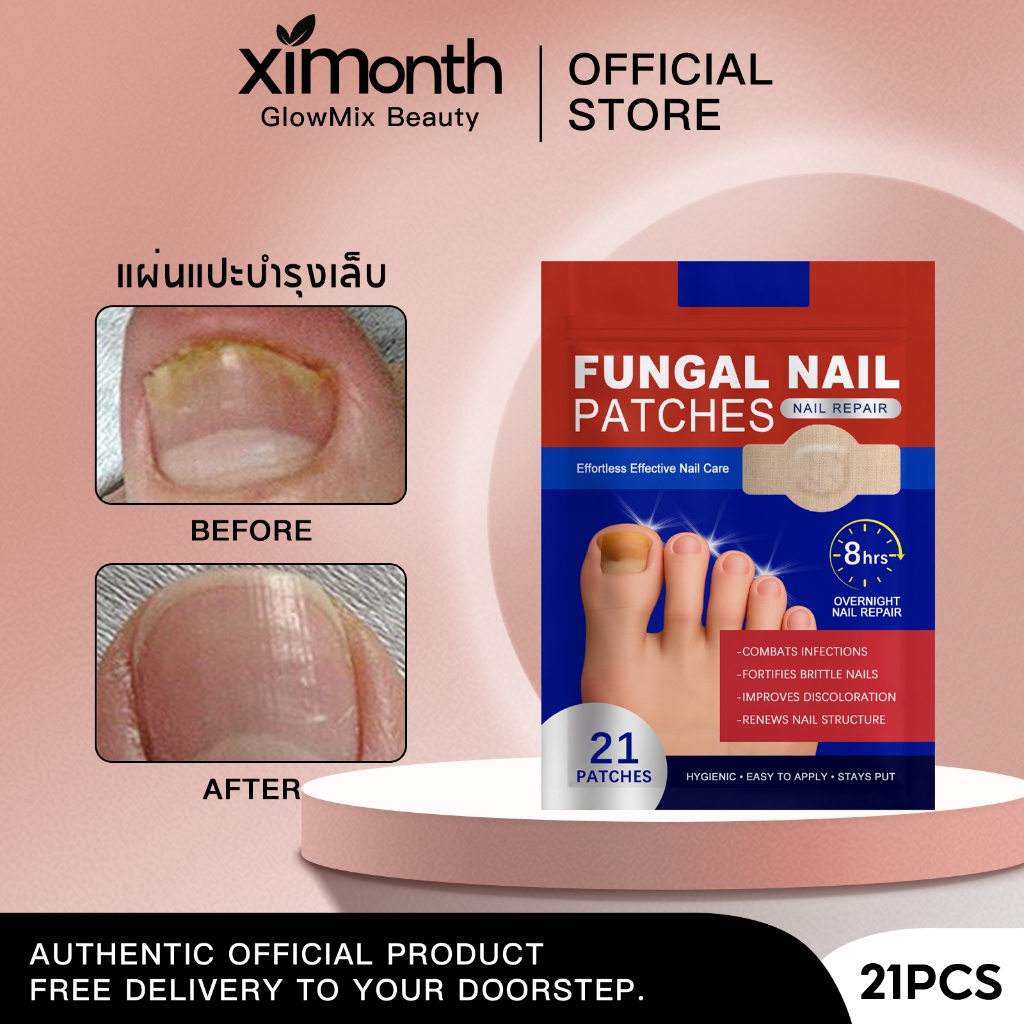 Ximonth แผ่นแปะดูแลเล็บเท้า แผ่นติดเล็บขบ บำรุงเล็บ สวมใส่สบาย ไม่รู้สึกเมื่อสวมรองเท้า ซ่อมเล็บ