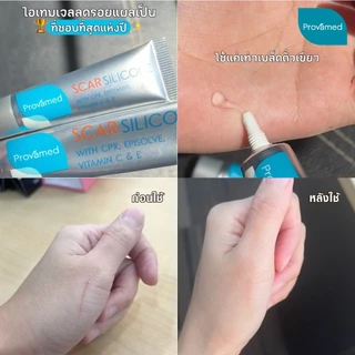 PROVAMED SCAR SILICONE 10 G โปรวาเมด สการ์ ซิลิโคน ผลิตภัณฑ์ดูแลผิวที่มีรอยแผลเป็น 10g