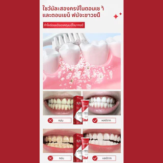 ยาสีฟันโปรไบโอติก ฟอกฟันขาวทันใจ ลดกลิ่นปาก ดูแลช่องปาก Whitening Toothpaste