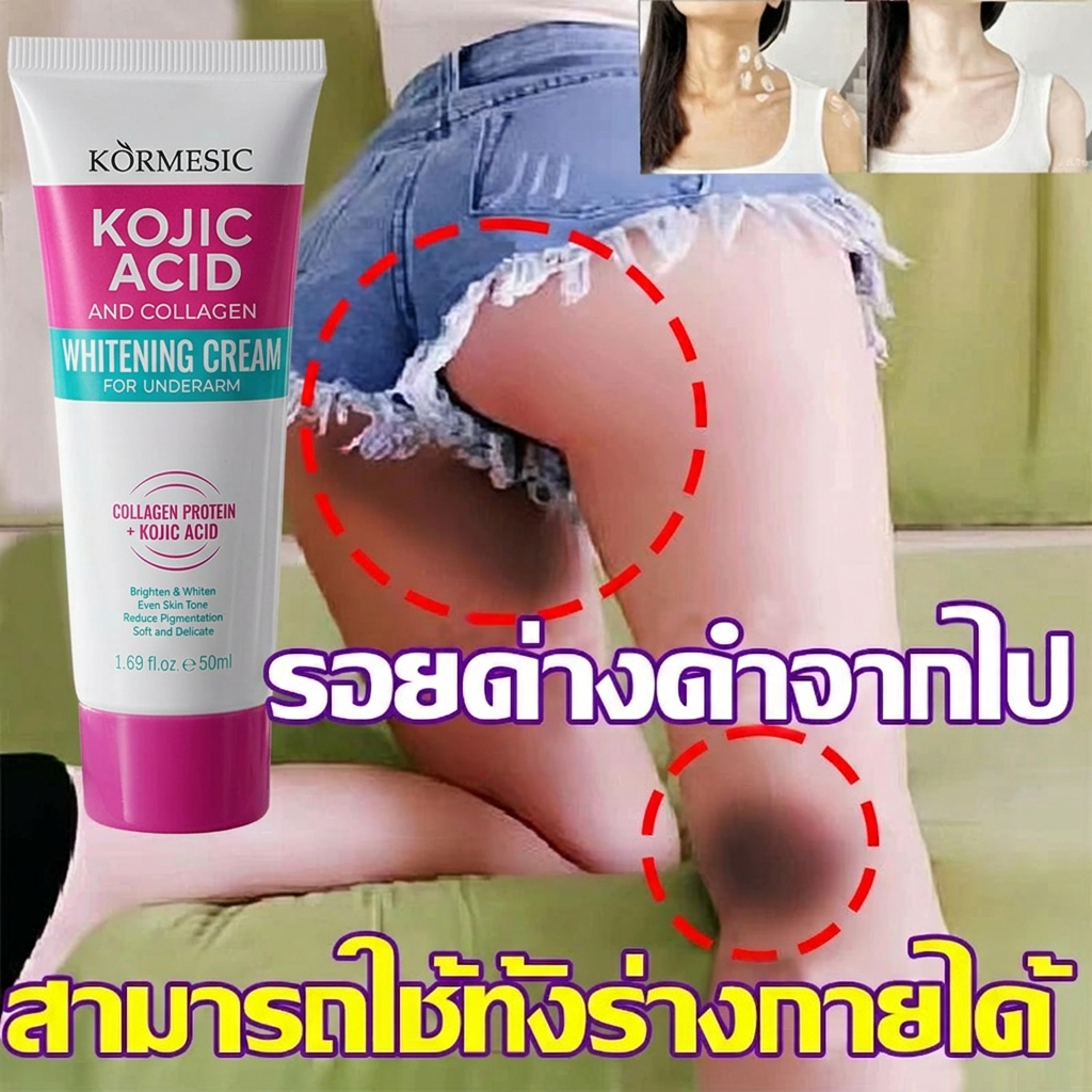 Kojic Acid ครีมขาหนีบดำ 50ml ครีมทารักแร้ขาว ครีมบำรุงรักแร้ เข่าดำ ผิวขาว สิ่งประดิษฐ์ ครีมขาหนีบดำ ครีมทาคอดำ