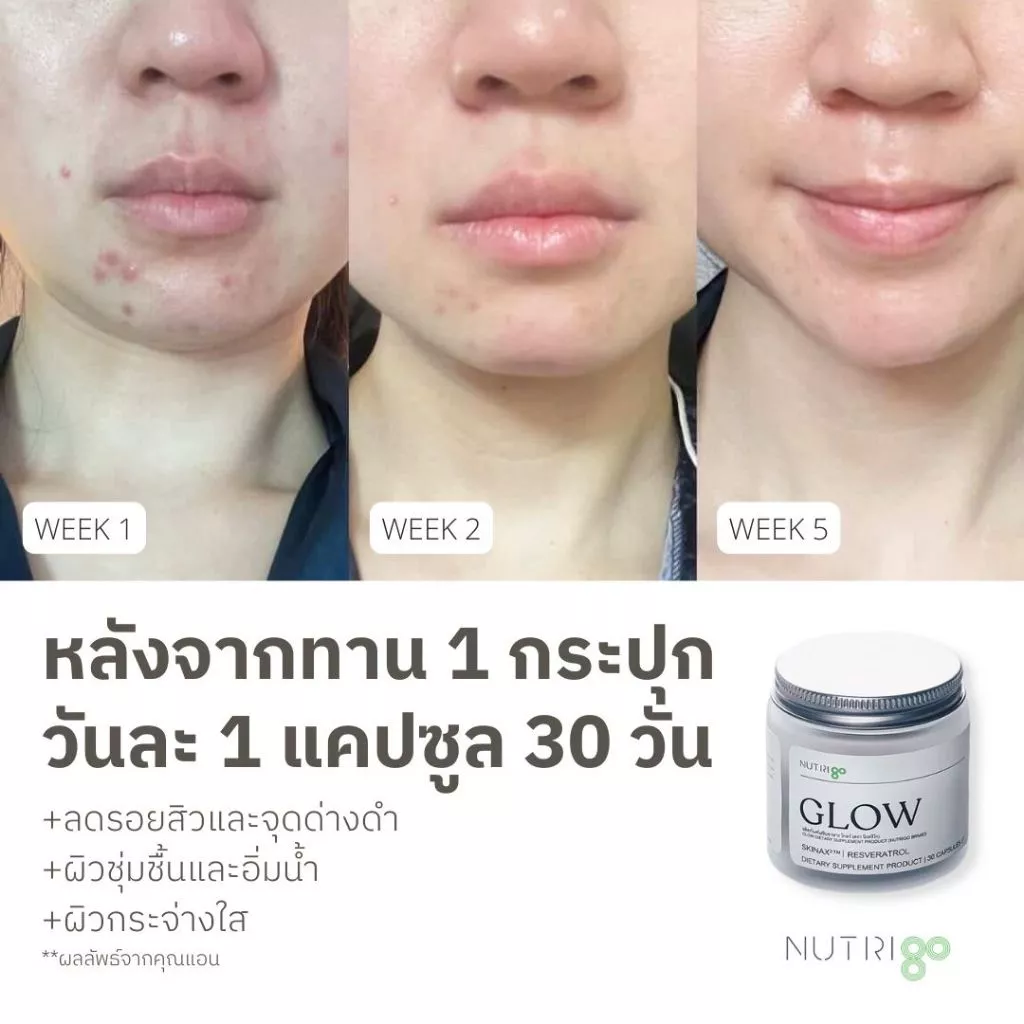 [โปร ส่งฟรี ส่งด่วน] NUTRIgo GLOW 30 แคปซูล วิตามินผิว หน้าใส ชุ่มชื้น ลดสิว ลดริ้วรอย ลดจุดด่างดำ SkinAx Resveratrol thumbnail 3