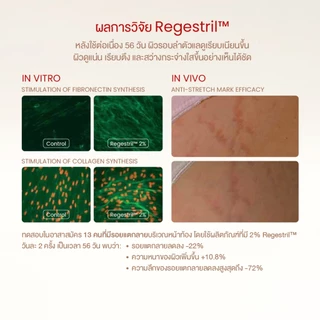 UP&UNDER: Skin Restore Nourishing Cream 100g ครีมเนื้อบาล์มบำรุงผิวกาย ลดเลือนรอยแตกลาย พร้อมฟื้นคืนความยืดหยุ่นของผิว
