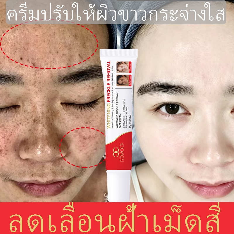 ครีมทาฝ้า  ครีมแก่ฝ้าทาผิวขาวแก้ฝ้าปรับปรุงผิวหมองคล้ำเติมความชุ่มชื้นบำรุงให้ผิวขาวอย่างมีประสิทธิภาพ15g