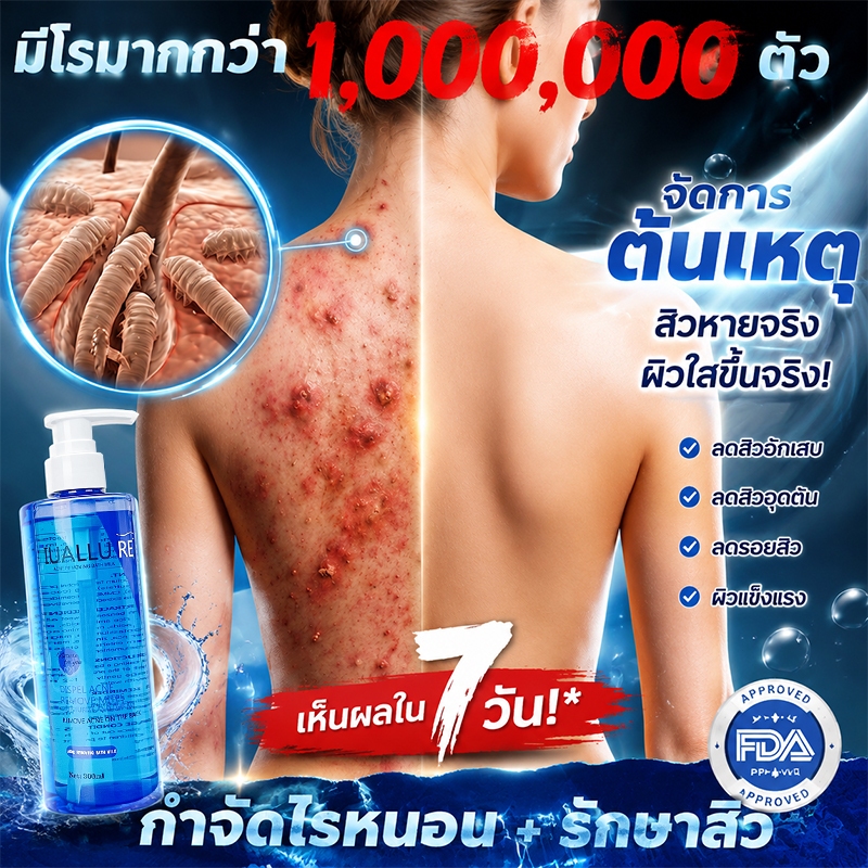 สบู่ลดสิว สบู่สิว สบู่สิวหลัง สกัดจากสมุนไพรจีน กำจัดไร กำจัดสิว ทำความสะอาดรูขุมขน ซ่อมแซมผิว ป้องกันการเกิดซ้ำ
