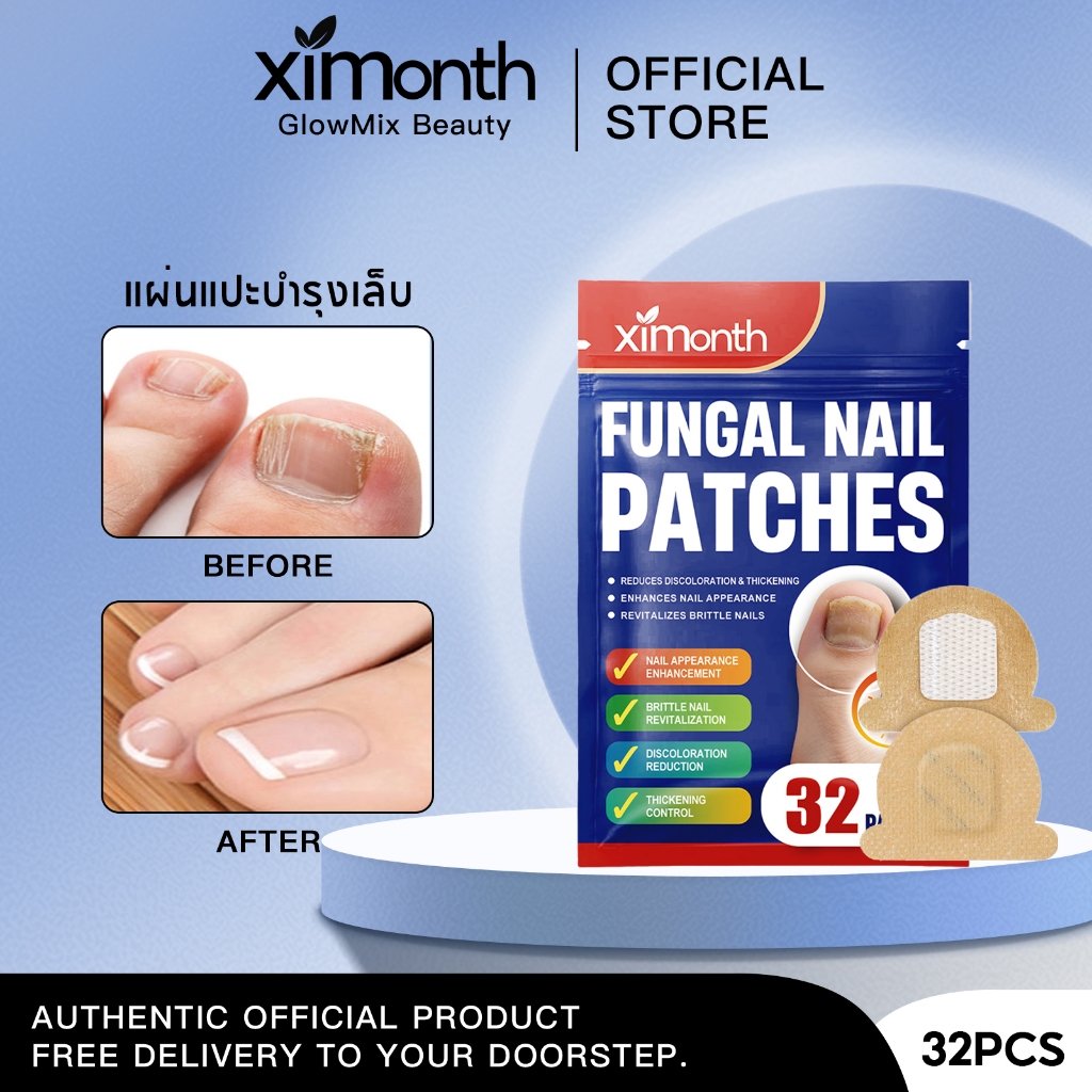 Ximonth แผ่นแปะเชื้อราที่เล็บ แผ่นซ่อมแซมเล็บ รักษาเชื้อราเล็บเท้า ใช้แล้วเชื้อราลดลง