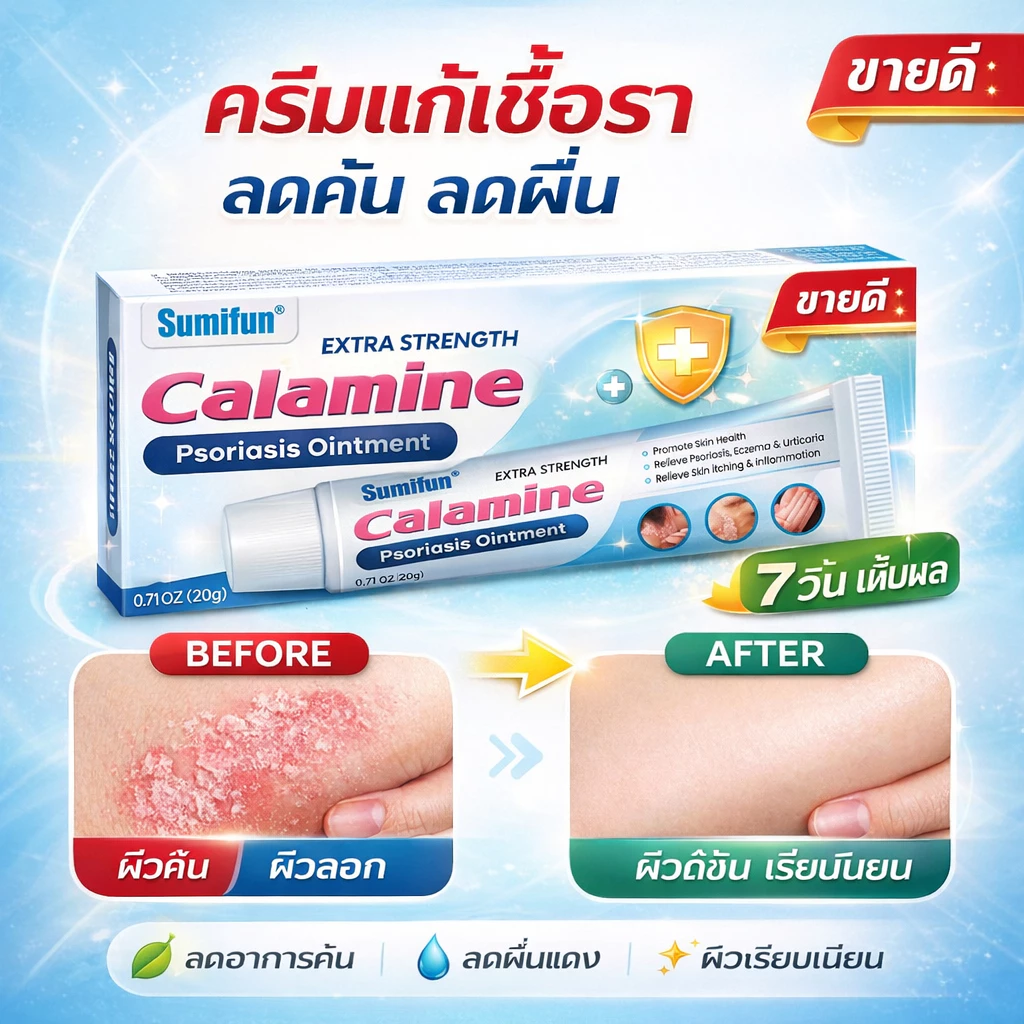 ⚡ หยุดคันเร็ว ⚡ครีมแก้เชื้อรา ช่วยยับยั้งเชื้อรา บรรเทาอาการคันและผิวลอก เนื้อครีมบางเบา
