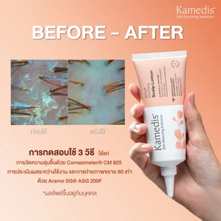 Kamedis | SCALP CONTROL Scalp Lotion 100 ML. สกาล์ป คอนโทรล สกาล์ป โลชั่น โลชั่นบำรุงหนังศีรษะแบบไม่ต้องล้างออก