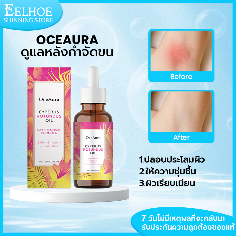Cyperus Rotundus น้ำมันบำรุงผิวหลังกำจัดขน 60ml ดูแลผิวอย่างอ่อนโยน ช่วยให้ผิวเรียบเนียน นุ่มชุ่มชื้น