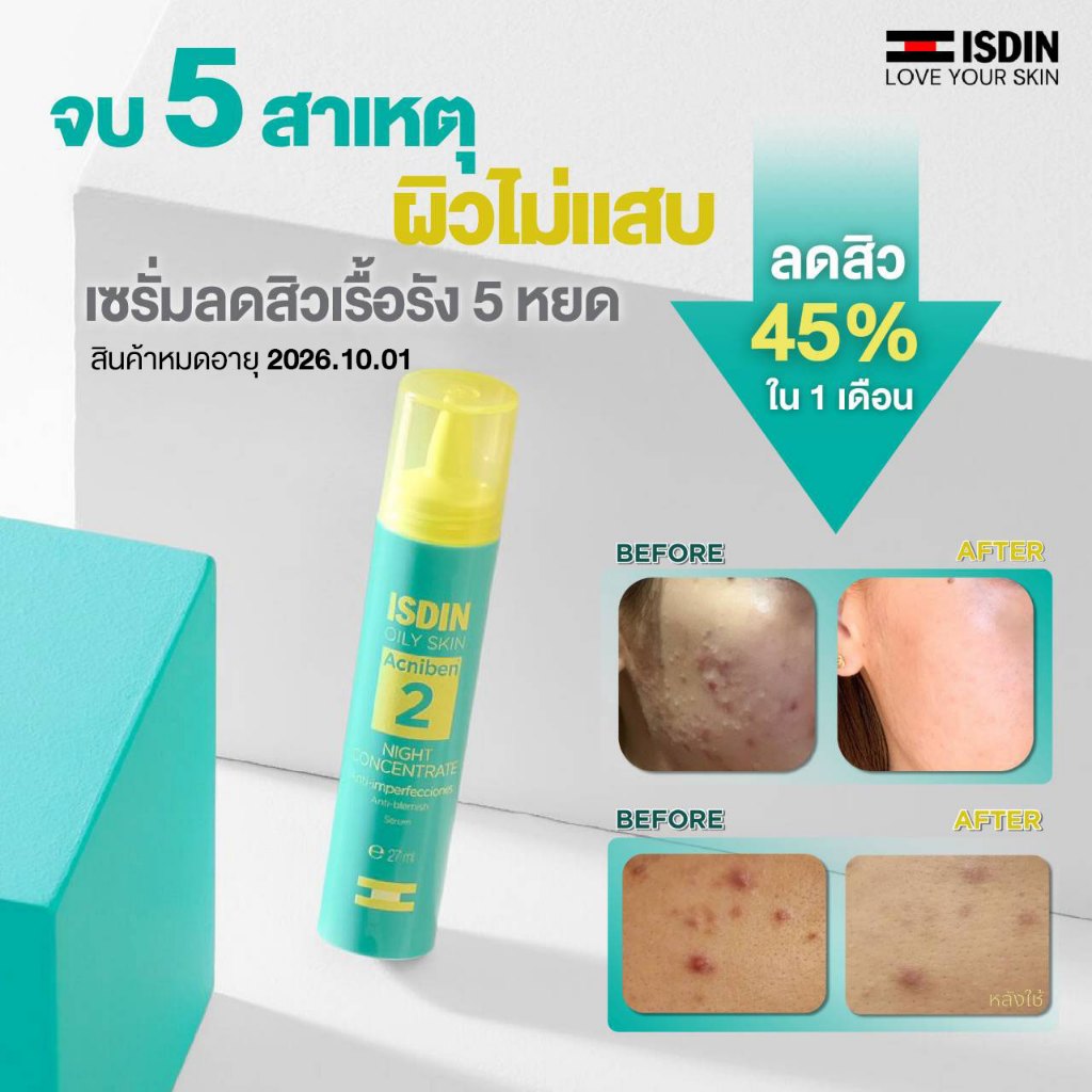 Acniben night  concentration ลด 5 สาเหตุสิว ผิวไม่แสบ พร้อมลดรอยแดง&ผิวมัน