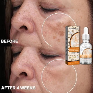 ครีมทาฝ้า 30ml ขจัดฝ้ากระ จุดดำ ผิวหน้าขาวใส