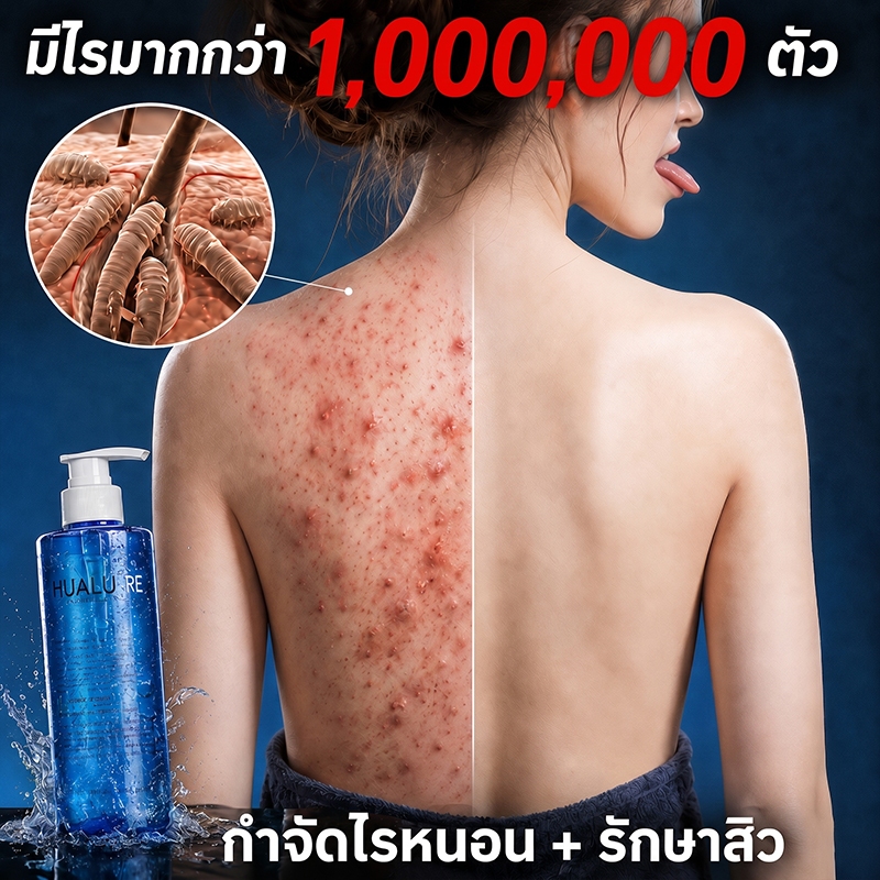 สบู่ลดสิว สบู่สิว สบู่สิวหลัง สกัดจากสมุนไพรจีน กำจัดไร กำจัดสิว ทำความสะอาดรูขุมขน ซ่อมแซมผิว ป้องกันการเกิดซ้ำ