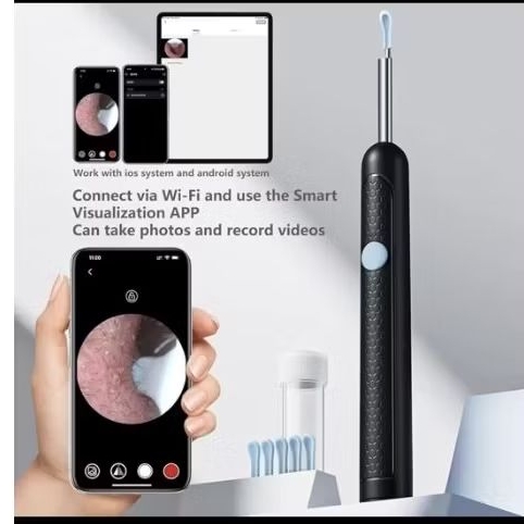 ไม้แคะหูไร้สาย กล้อง HD 360° สำหรับทำความสะอาดหู